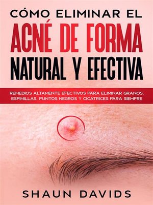 cover image of Cómo Eliminar el Acné de Forma Natural y Efectiva